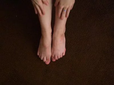 Tiny feet stubby toes by MillanaMoor
